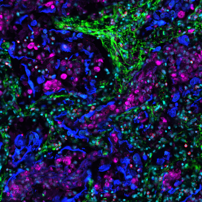 Blog: Immuno-oncology: look beneath the surface with multiplex sequential immunofluorescence (seqIF™)
