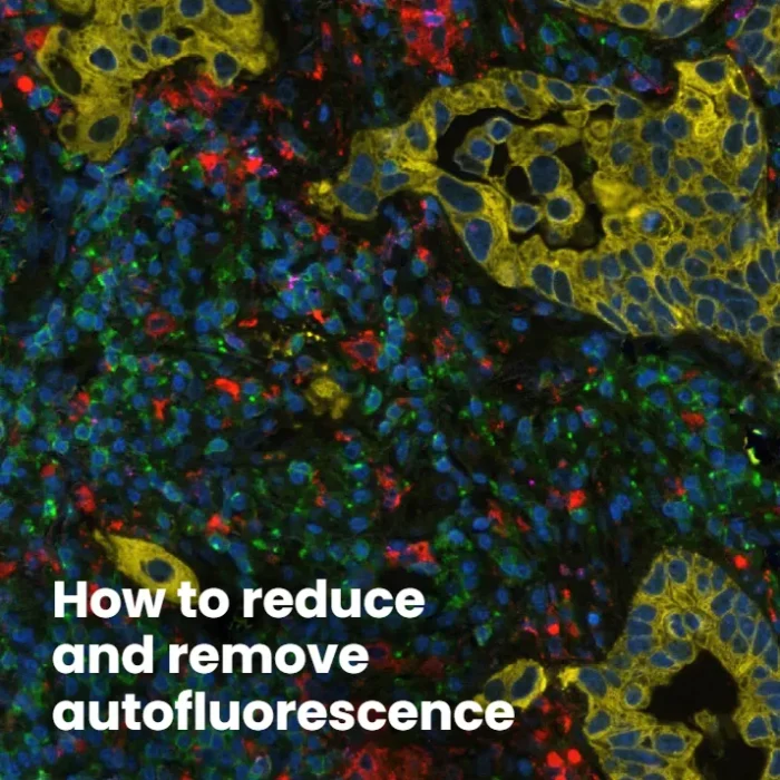 How to reduce and remove autofluorescence