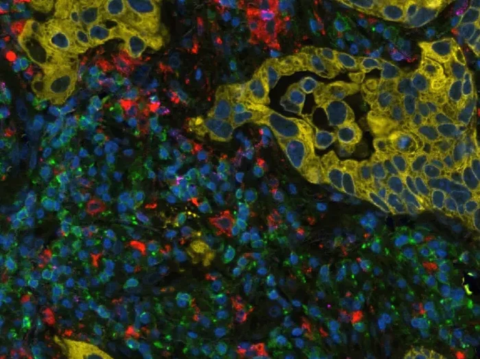 How to reduce and remove autofluorescence