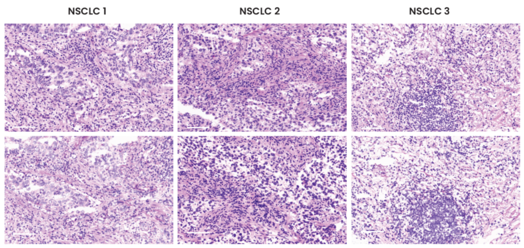 Hyperplex analysis on delicate frozen samples: now possible with high ...