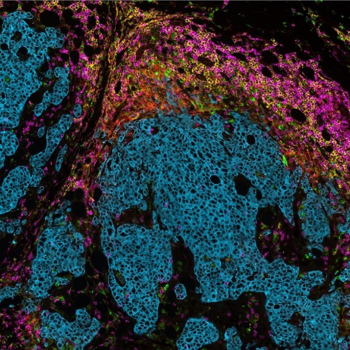 Highly reproducible multiplexed immunofluorescence assays: From discovery to translational research