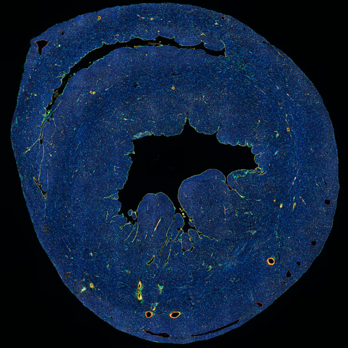 DAPI αSMA CD31 PDGFRa Tnnt2  multiplex image of heart (mouse frozen section)