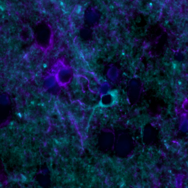 Blog: Unraveling brain heterogeneity: exploring cellular diversity and molecular patterns with multiplex immunofluorescence