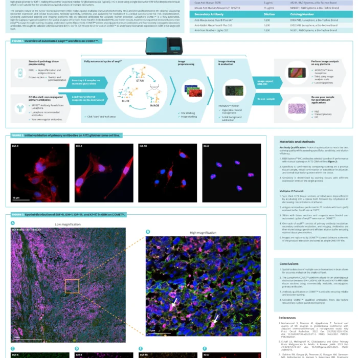 Evaluation of IDH-1, EGF-R, IGF-1R and Ki-67 biomarkers in glioblastoma using the Lunaphore COMET™ platform
