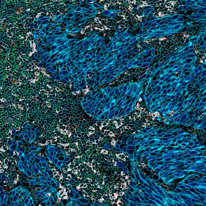 Blog: Marker-informed cell segmentation with HORIZON™