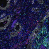 Spatial proteomics: six barriers to multiplex immunofluorescence marker optimization and how to overcome them
