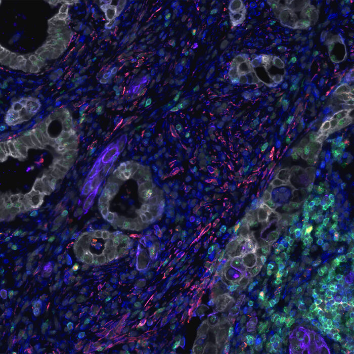 Blog: Spatial proteomics: six barriers to multiplex immunofluorescence marker optimization and how to overcome them
