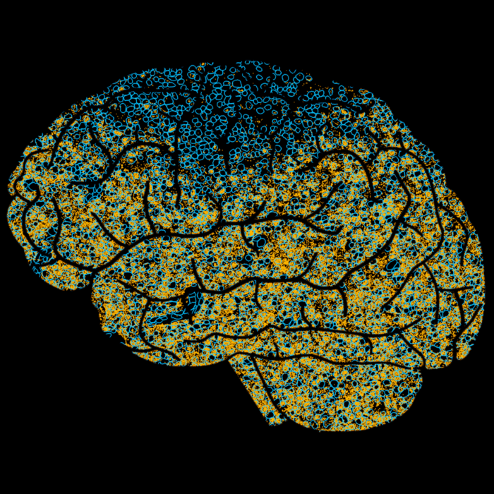 Blog: HORIZON™ drives insights into the glioblastoma tumor microenvironment