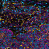 Marker-informed cell segmentation with HORIZON™