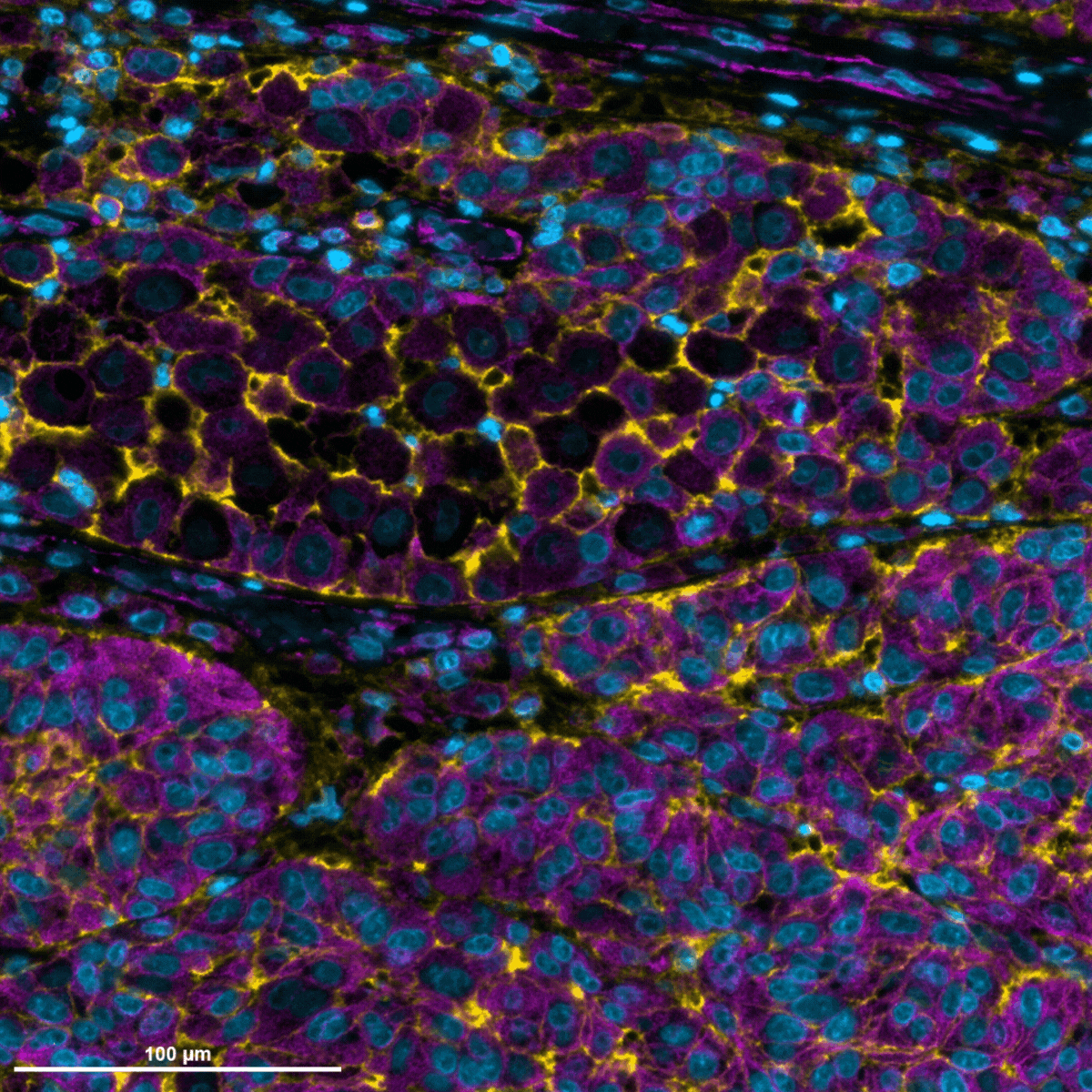 Blog: Marker-informed cell segmentation with HORIZON™