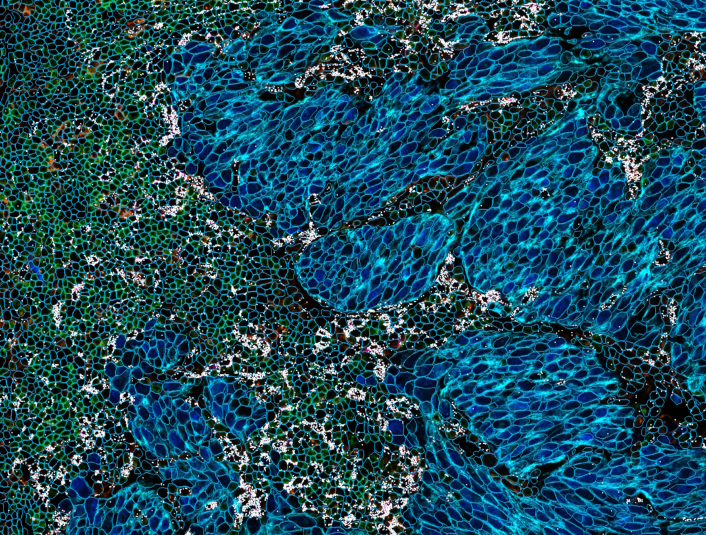 Cell Segmentation Spatial Marker-informed cell segmentation with HORIZON™ - Lunaphore Technologies