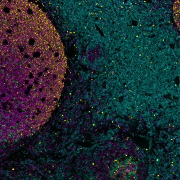 23rd Meeting of the European Association for Haematopathology